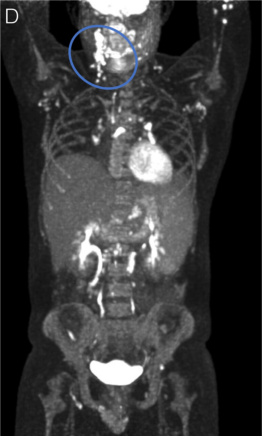 https://www.iasusa.org/wp-content/uploads/tam/figures/tam-36-605-g018d.png