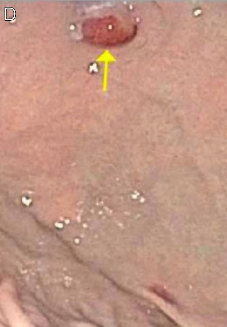 https://www.iasusa.org/wp-content/uploads/tam/figures/tam-36-605-g021d.png