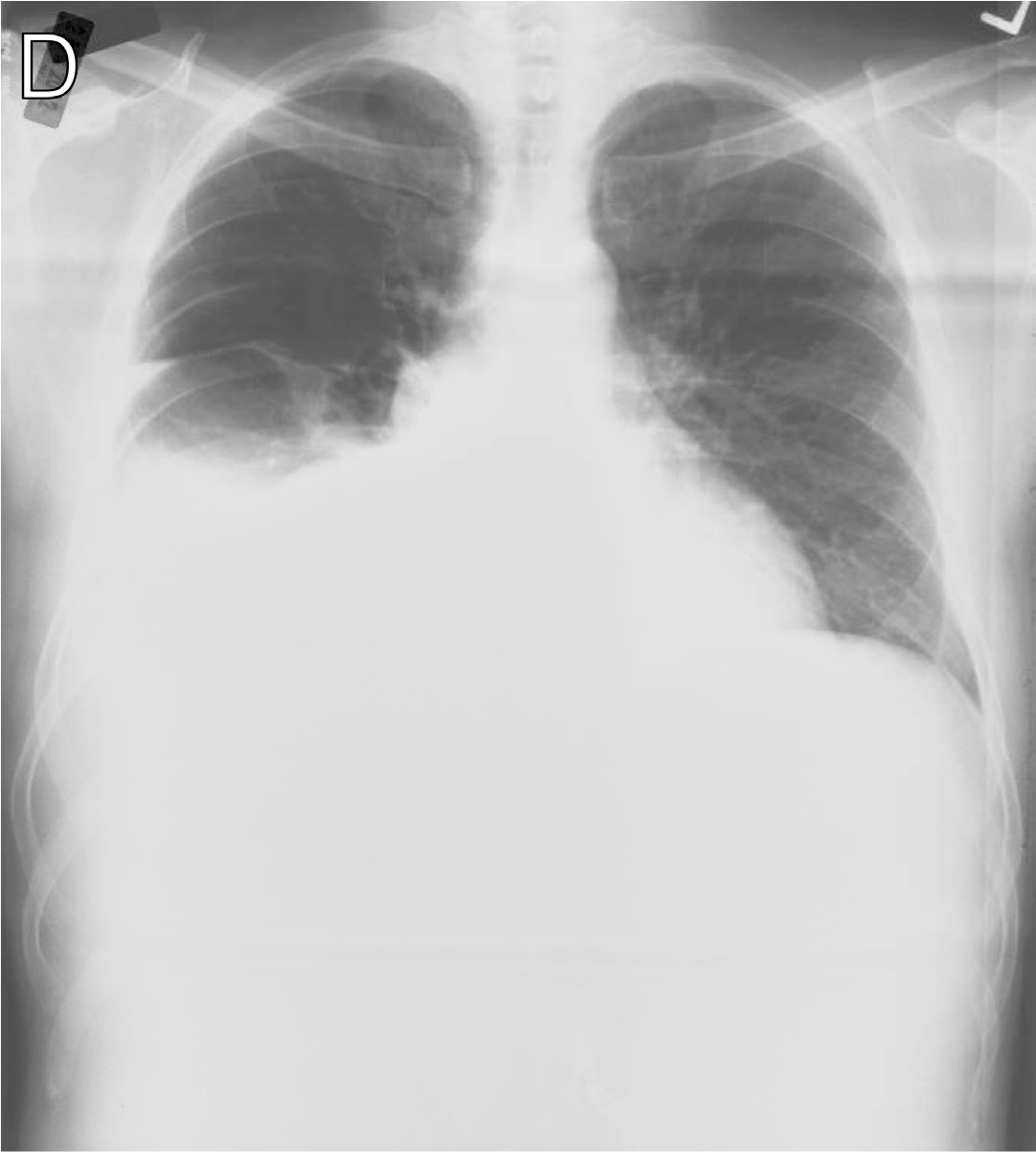 https://www.iasusa.org/wp-content/uploads/tam/figures/tam-36-605-g031d.png